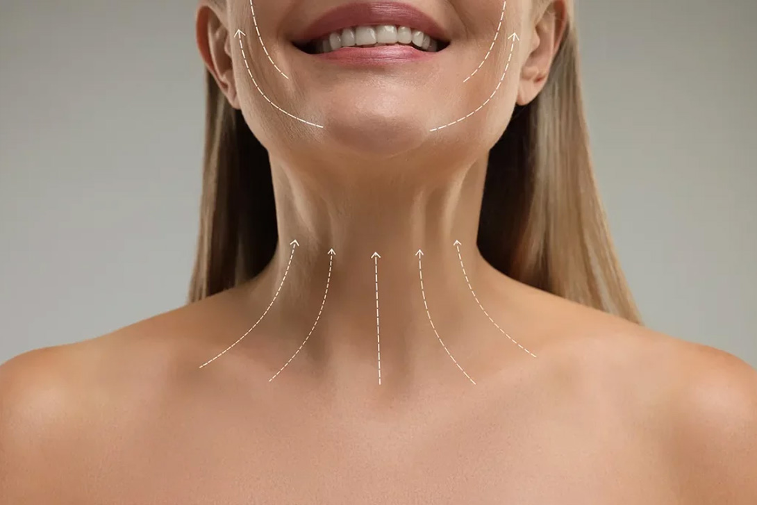 durée de vie d’un lifting du visage