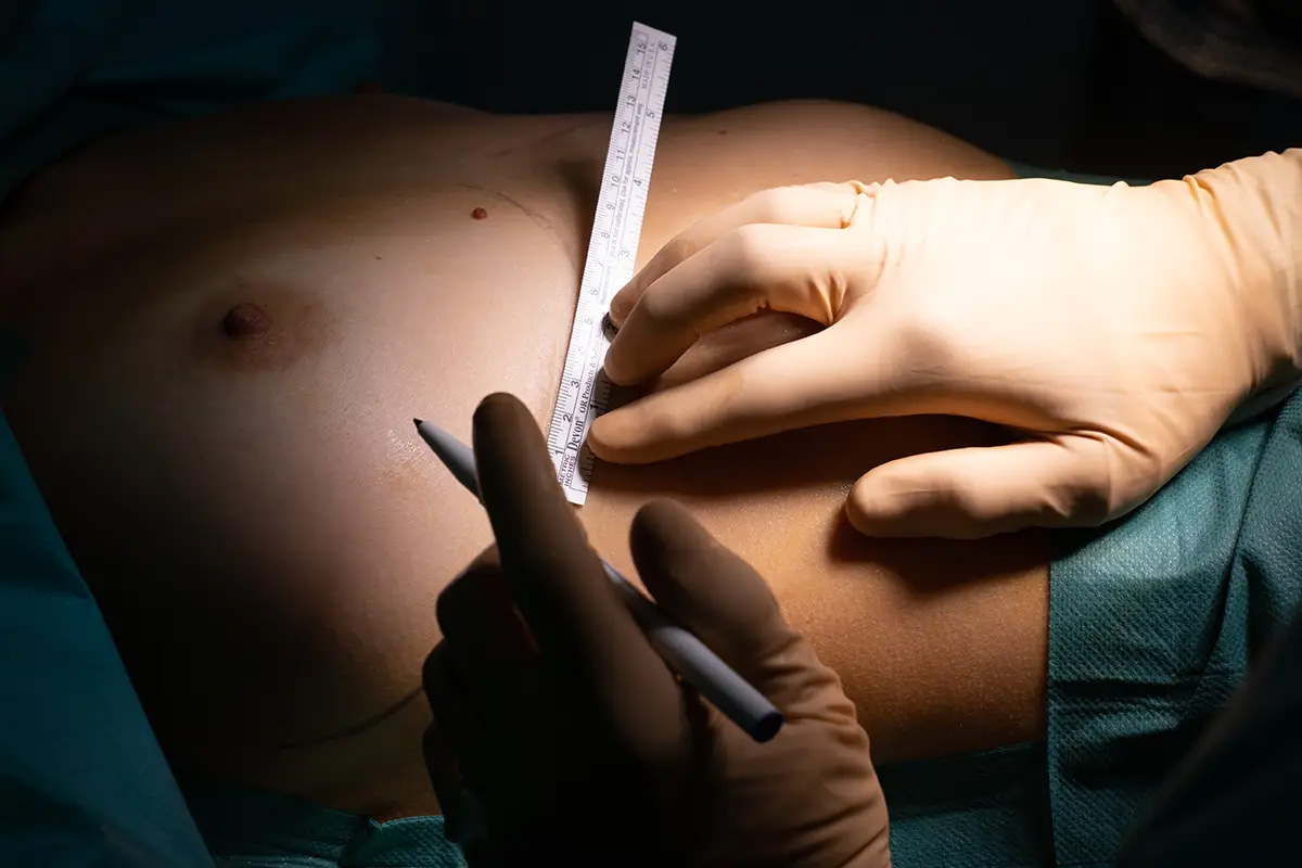Intervention seins