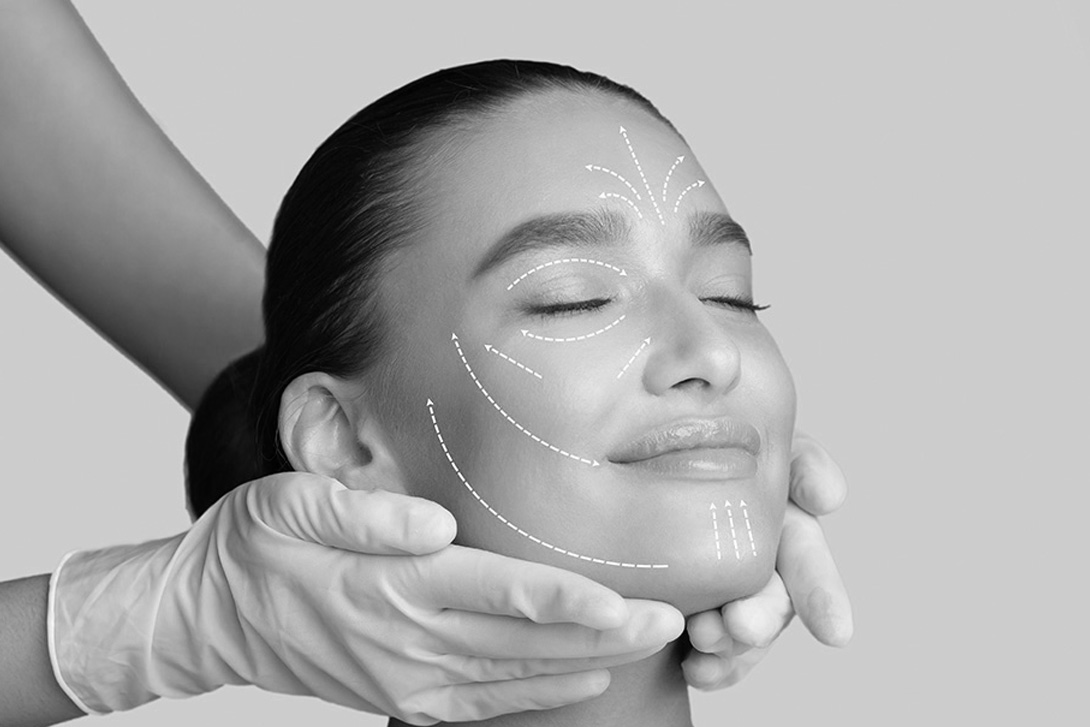 Lifting cervico facial