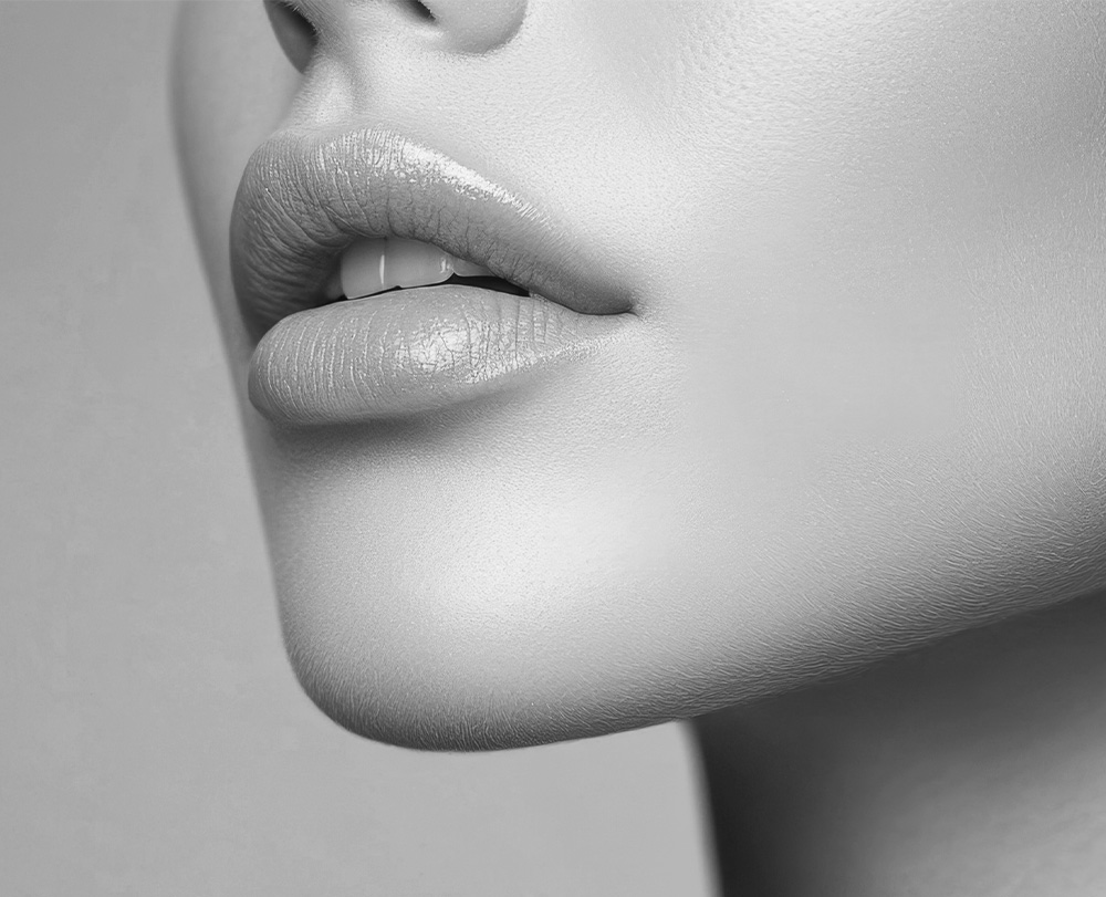 Lip lift