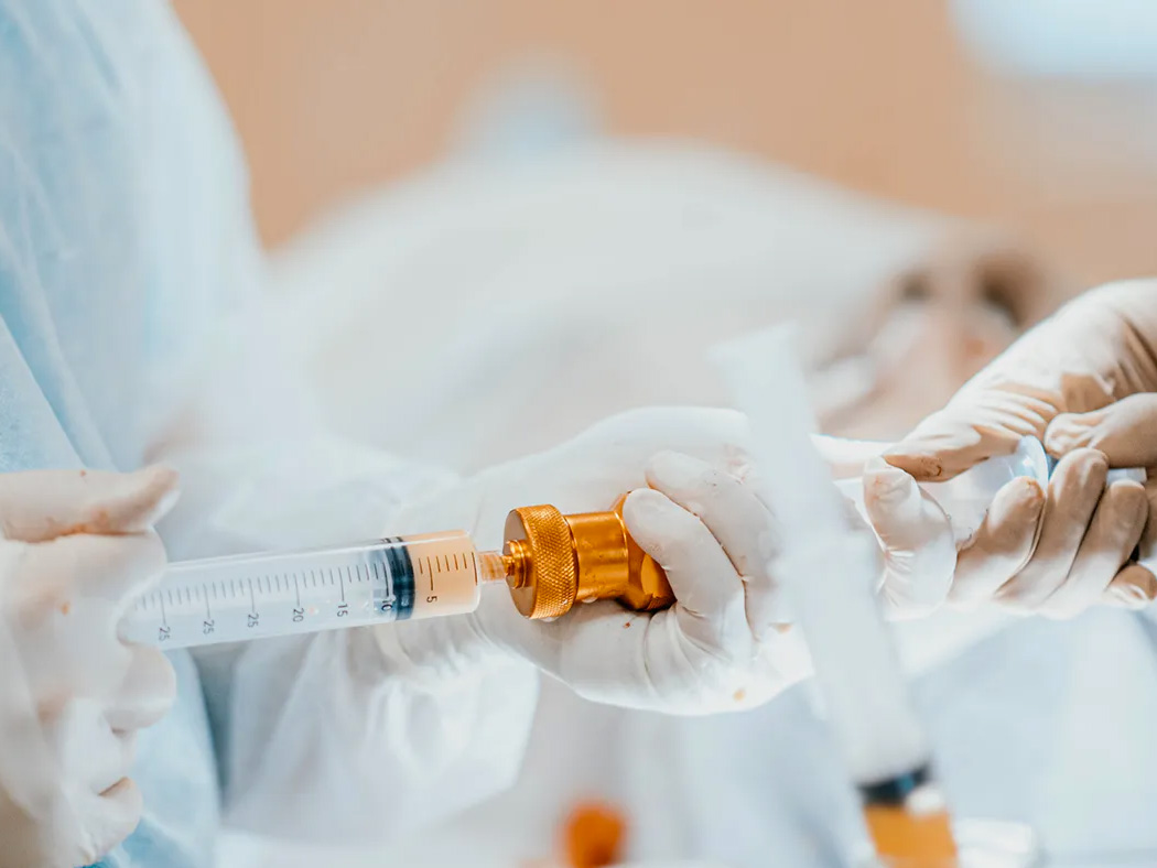 Lipofilling