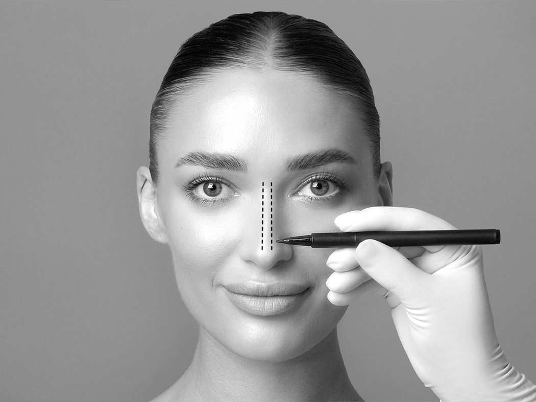 Les suites opératoires de la rhinoplastie