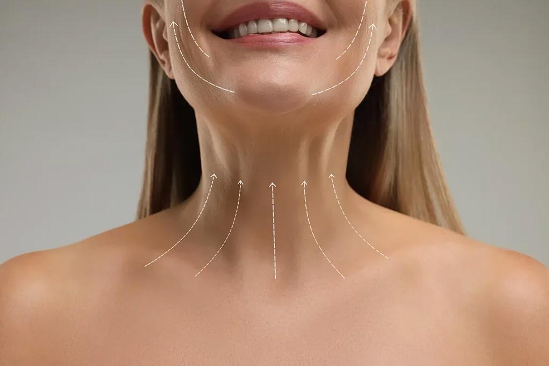 durée de vie d’un lifting du visage