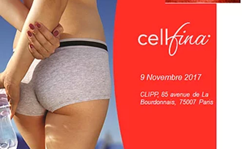 Formation Cellfina à Paris
