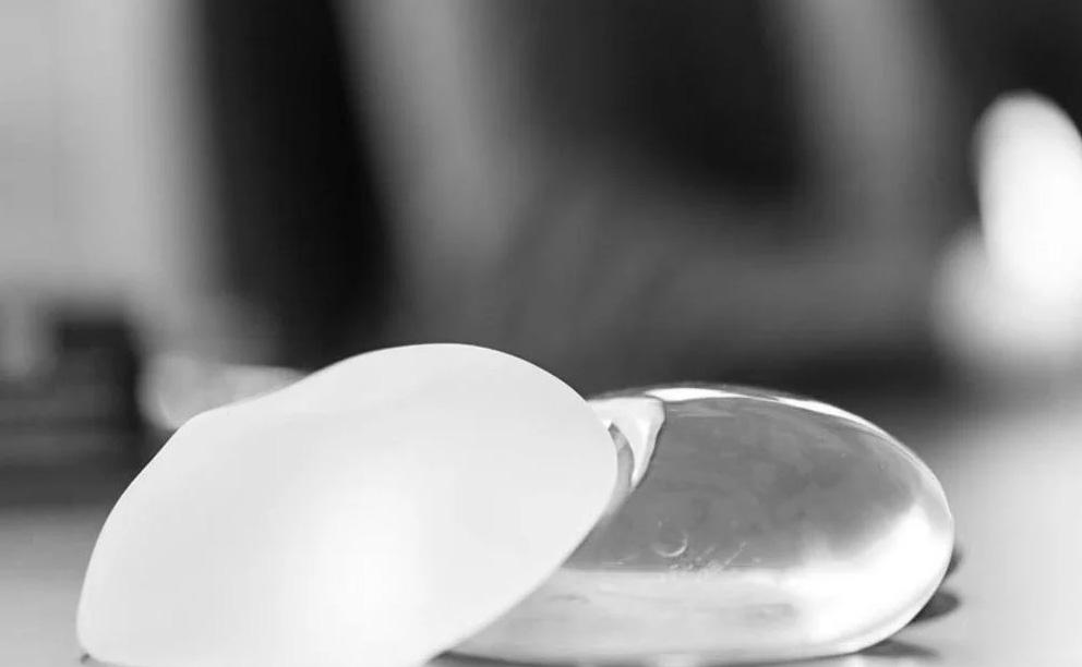 Interdiction de l’implantation de prothèses mammaires