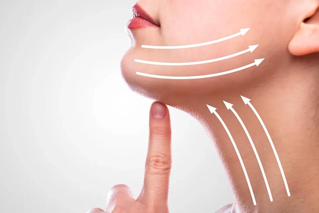 Lifting du cou et du visage
