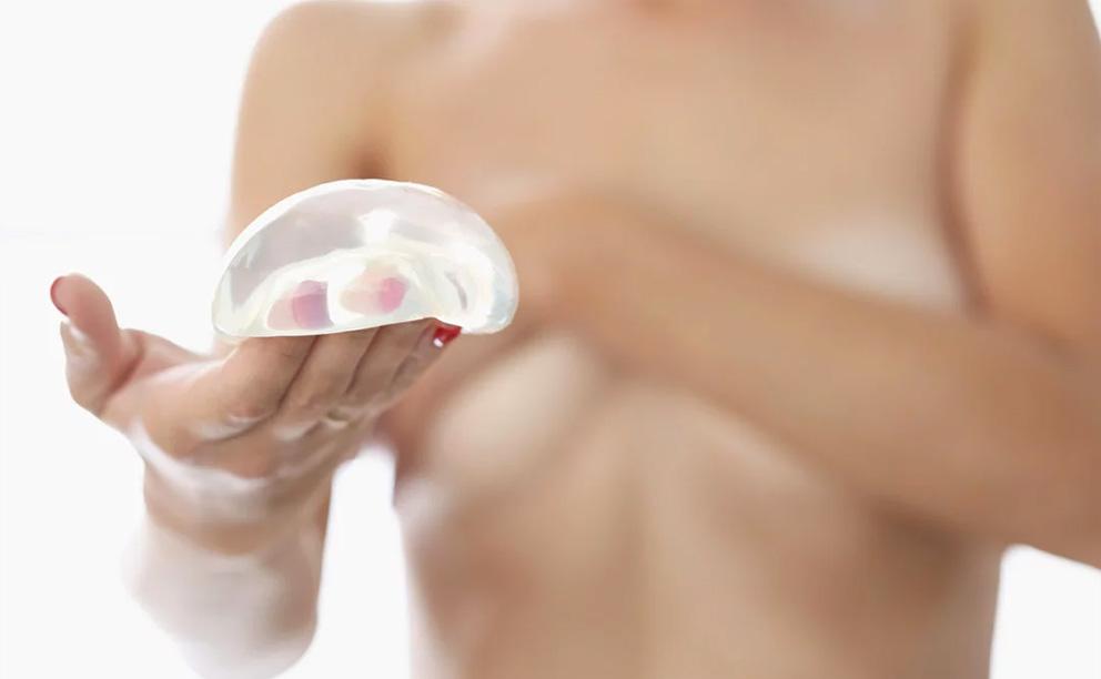 Lifting des seins