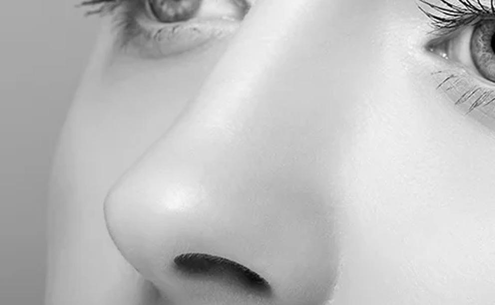 Rhinoplastie médicale et chirurgicale