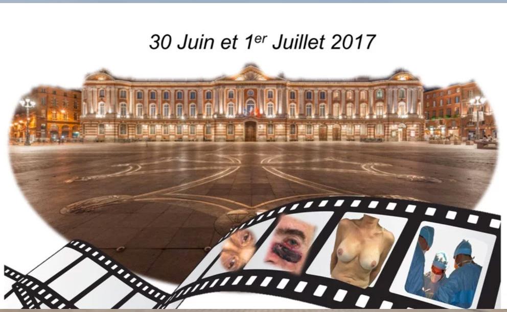 Vidéoforum Toulouse Juin 2017