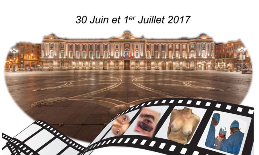 Vidéoforum Toulouse Juin 2017
