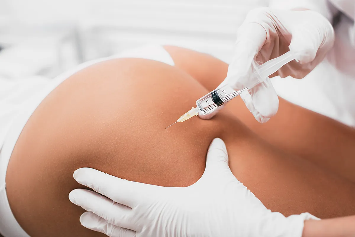 complication après epilation laser